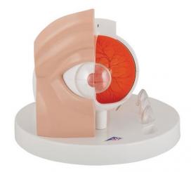 Augenmodell Pathologisches Auge 