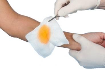 Verbandmull NOBAMED 10 cm x 10 m 